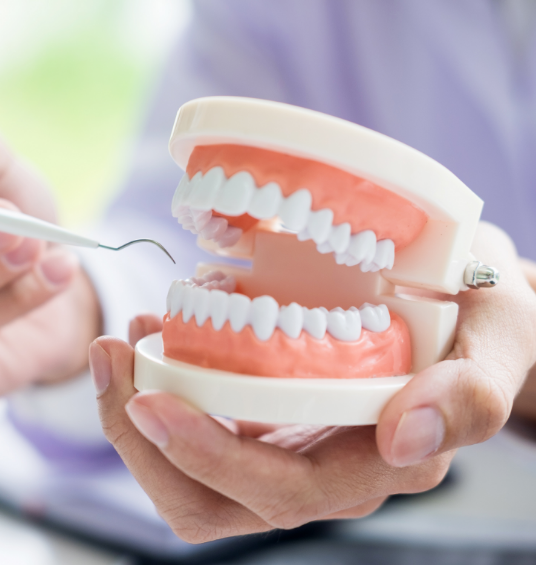 Quelles sont les étapes de 
la pose d’un implant dentaire ?